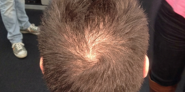 Cortes de pelo para hombres con entradas en 2026